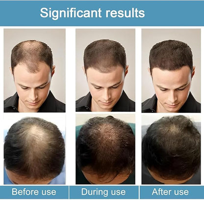 Goodovio Hair Renewal Kit™